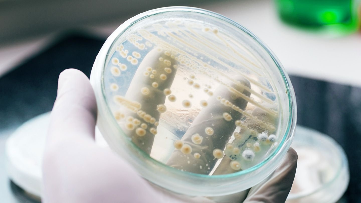 Candida Auris Outbreak in Washington Sparks Global Health Concerns ...